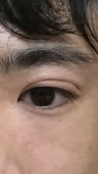 高１男です はじめてアイプチをつけたのですが 写真は不自然な二重 Yahoo 知恵袋