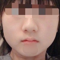 私って鼻でかいですか 口が小さすぎるだけですか 口は4cmほどしかありませ Yahoo 知恵袋