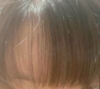 前髪の左側が薄いです 女子高生なんですが なぜか左側の前髪だけ薄いと Yahoo 知恵袋