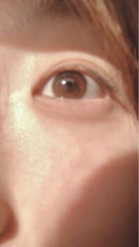 黒目の中にシミのようなものが あるのに最近気が付きましたこれ Yahoo 知恵袋