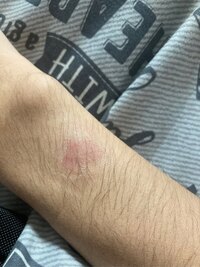 Applewatchのタッチの反応が悪いです タッチの反応が悪いという Yahoo 知恵袋