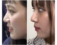 たぬき えみり ん