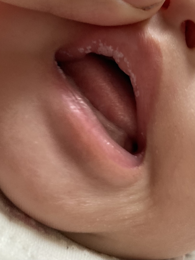 3ヶ月の赤ちゃんの唇と声枯れについてわかる方いらっしゃいますか 昨日 Yahoo 知恵袋