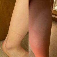 浮腫とただの太りやすいどう違いますか 今日は67 昨日は68 一 Yahoo 知恵袋