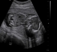 17週の妊婦です 検診でのエコーを見て 毎回不安になってしまうのですが こ Yahoo 知恵袋