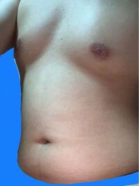 歳身長172 体重78キロの男性なのですが 皆さんから見てど Yahoo 知恵袋