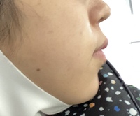 口の横の肉 脂肪 というか口角 をとるにはどうしたらいいです Yahoo 知恵袋