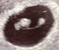 6週６日に心拍確認が出来ました エコー写真をもらいました こんなにハ Yahoo 知恵袋