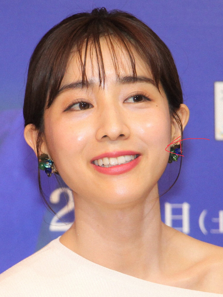 これは何か手入れをしてるんでしょうか 写真の矢印のあたりです 田中み Yahoo 知恵袋