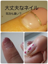 ジェルネイルについての質問です 施術後2日で根元に違和感を覚え 現在 Yahoo 知恵袋