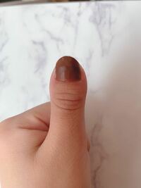ネイリストの方に回答をお願いします バチ爪の方や短頭指 俗名マムシ指 の Yahoo 知恵袋