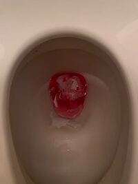 汚い写真ですが病院に行った方が良いですか トイレで大便をするとこんな感じで Yahoo 知恵袋