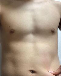 閲覧注意 これは正面からの写真で 横から見るともう少し太って見えま Yahoo 知恵袋