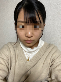 汚いノーマルの写真失礼します 肌が黄土色 だと言われます 調べたら病 Yahoo 知恵袋