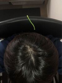 代半ばの男です 頭頂部の分け目の写真なんですが これってはげてます Yahoo 知恵袋