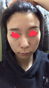 助けて下さい このおでこ変ですか 長すぎですか どこが変か教えてくださ Yahoo Beauty