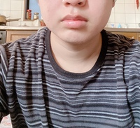 自分ってこれ顎周りの脂肪ありますか 正直に答えてほしいです 口元 Yahoo 知恵袋