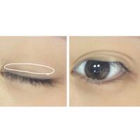 絶対に戻らない自力で二重まぶたにする方法アイプチ以外で二重になる方 Yahoo 知恵袋