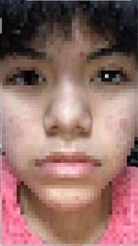 どこを整形すればいいでしょうか 私的には真ん中の肉厚を取り 小鼻 Yahoo 知恵袋
