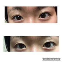 中学生です ブスがコンプレックスです なので アイプチをしてます 去年 Yahoo 知恵袋