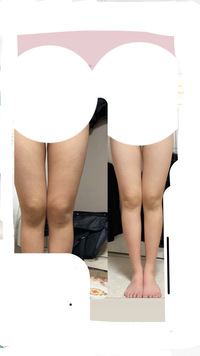 足パカを2週間続けていますが 足の隙間が小さくなった気がします 足パカって Yahoo 知恵袋