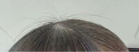 アホ毛が酷いんです マトメージュやアホ毛のスティックで抑えても、限界があります。うねうねのアホ毛が生えてきます。

どうしたら直りますか？ ほんとに悩んでるんです、、