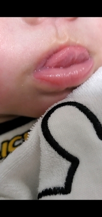 生後3ヶ月半の赤ちゃんが上唇を舌でちゅぱちゅぱします これは 遊 Yahoo 知恵袋