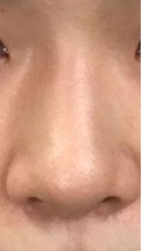 優性遺伝は 劣性遺伝 主人がいわゆる豚鼻です 鼻が短く 鼻の Yahoo 知恵袋