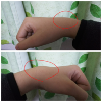 手を着くと手首が痛いです 右手は大丈夫なのですが左手が痛いです 写真 Yahoo 知恵袋