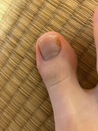 爪に黒い点があるのですがこれは何でしょうか 病気ですか Yahoo 知恵袋