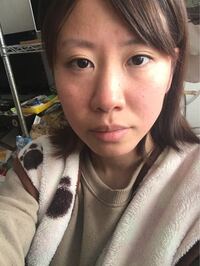 整形してる人に質問です どこをいじったら顔整いますか 鼻が Yahoo 知恵袋