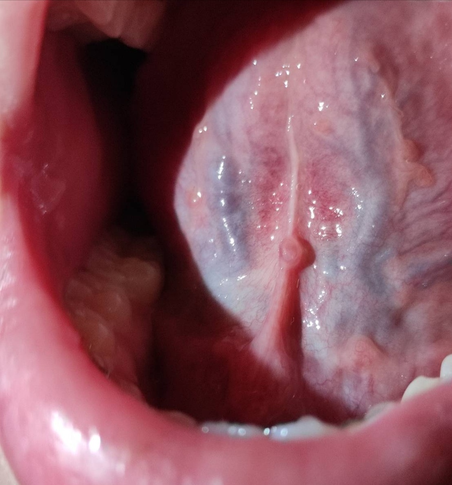 病院 検査 解決済みの質問 Yahoo 知恵袋