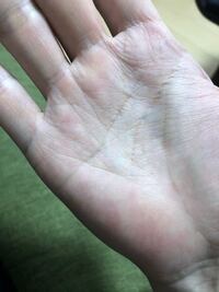 小指下から生命線に伸びる線は 財運線ですか それとも健康線ですか Yahoo 知恵袋