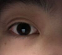 まぶたや眉毛とか目周辺のマッサージでまぶたが伸びるってありますか Yahoo 知恵袋