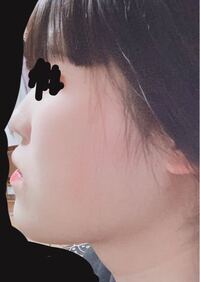 友達に横顔ブスと言われました 整形しようと思います 体は痩せ Yahoo 知恵袋