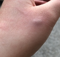 飼い犬に噛まれました 本気で噛まれたわけではありません 抱っこし Yahoo 知恵袋