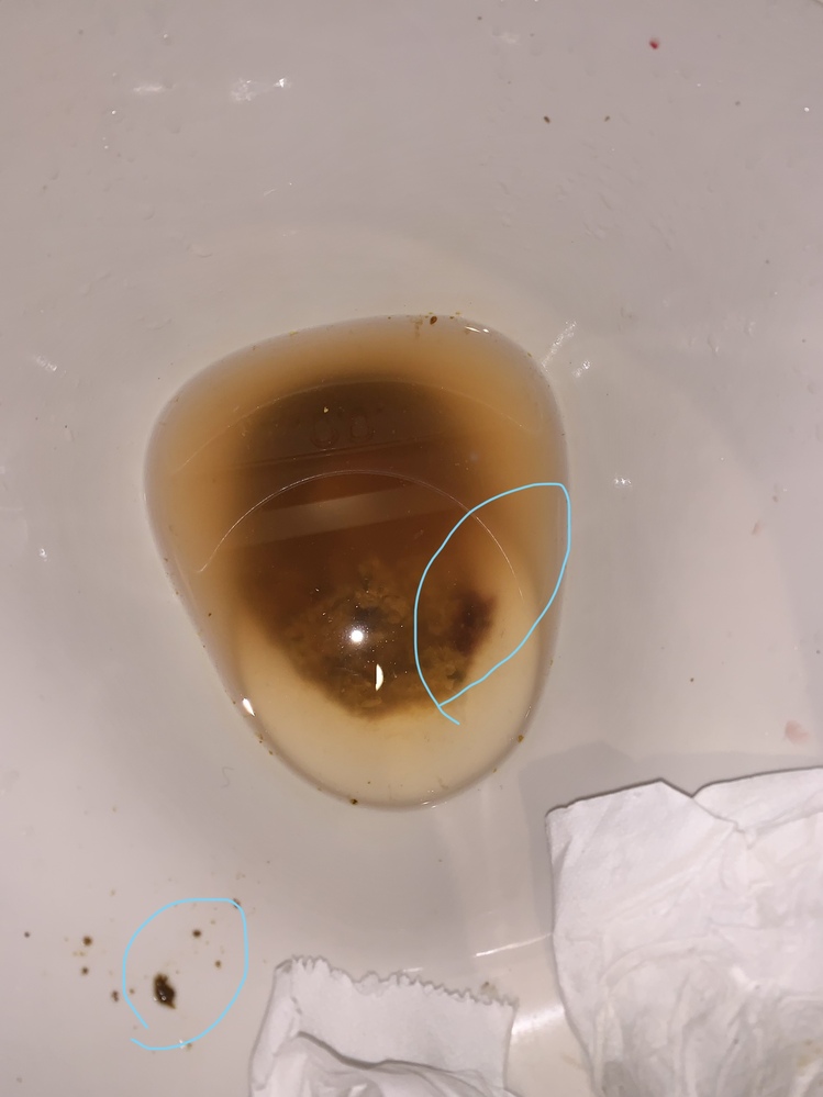 画像閲覧注意です 長年便秘気味で 脱肛気味なのですが 最近何回か便に初めて Yahoo 知恵袋