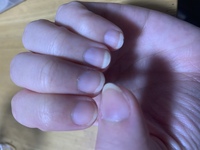 汚い爪ですいません 代女ですが 自分の爪が醜くて困っています 昔は 家 Yahoo 知恵袋