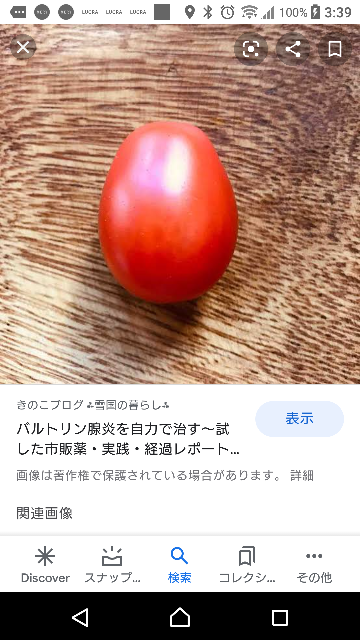 バルトリン腺炎と調べたらこの画像が出てきたんですが バルトリン腺炎ってこん Yahoo 知恵袋