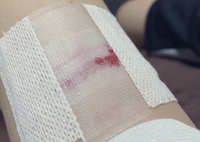 リストカットの代替はなにが良いでしょうか リストカット アームカット をしてい Yahoo 知恵袋