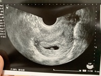 妊娠7週3日の初妊婦です 本日 クリニックを受診したところ Yahoo 知恵袋