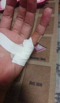 閲覧注意 Lineの返信が遅いことが原因で彼女と口論になり 切りつ Yahoo 知恵袋