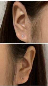 ピアスの位置が左右非対称になってしまいました 今日 初めてピアス Yahoo 知恵袋