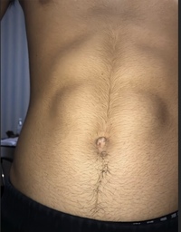 高2でこの腹毛は濃いですか Yahoo 知恵袋