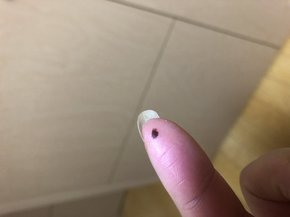 皮膚の病気 アトピー 解決済みの質問 Yahoo 知恵袋