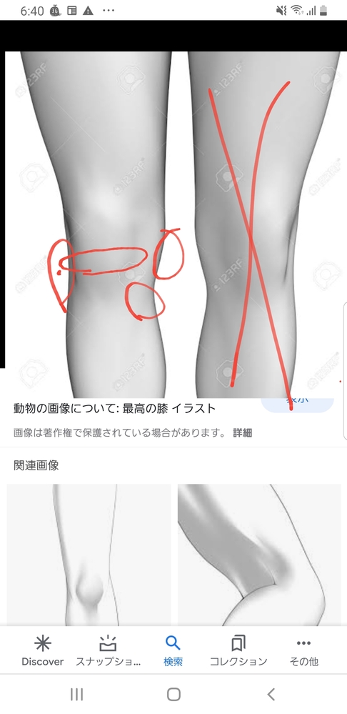 膝の痛みについてです バスケをしてる最中に右膝が伸びたまんま Yahoo 知恵袋