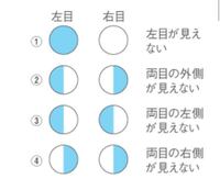 脳内病変による視野欠損や視野狭窄って写真のように表現されてますが Yahoo 知恵袋