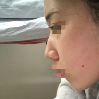 鼻がコンプレックスで愛沢えみりちゃんみたいなアップノーズ っぽい鼻にしたい Yahoo 知恵袋