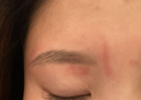 松ヤニのワックス脱毛をサロンで眉毛にしてもらいました 所々 Yahoo 知恵袋