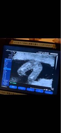 妊娠中で 16w5dです 今日 検診で外性器を見てもらいま Yahoo 知恵袋